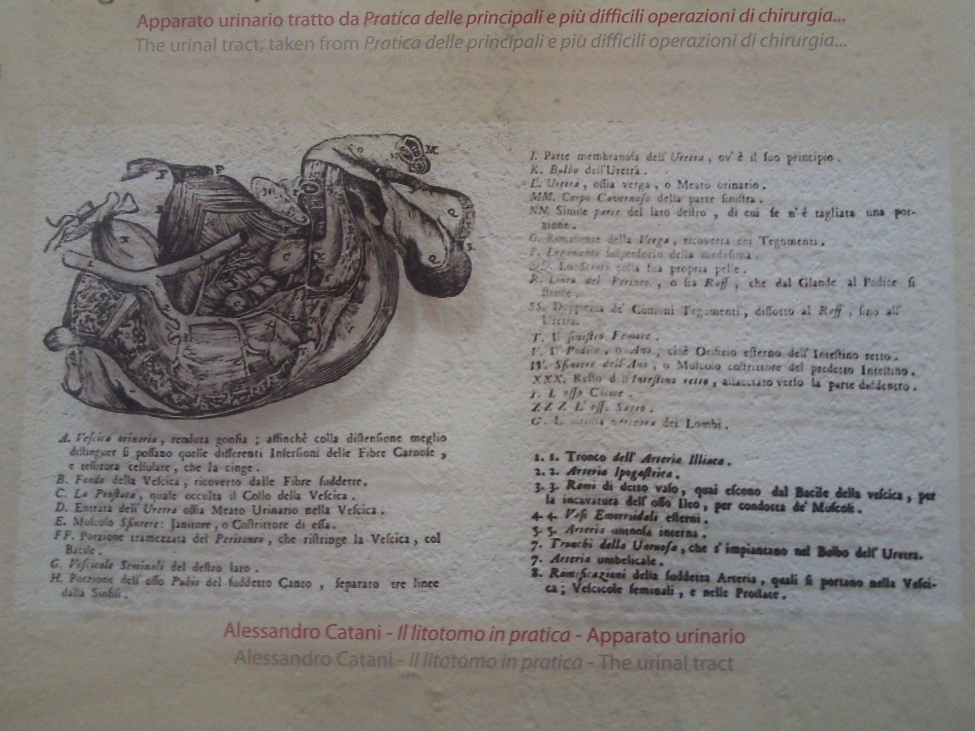 Museo chirurgia popolare Preci12.jpg